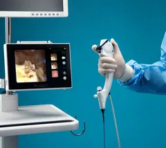 Ендоскоп і монітор відеоендоскопічної системи